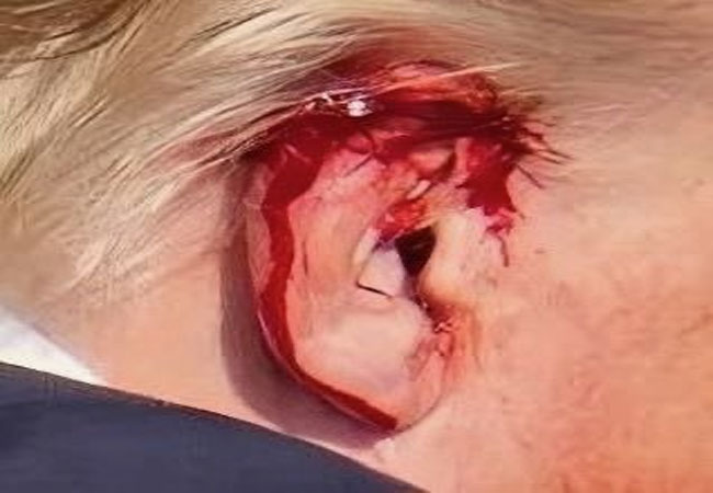 US Former President Donald Trump Horrific Attack During Rally in Pennsylvania