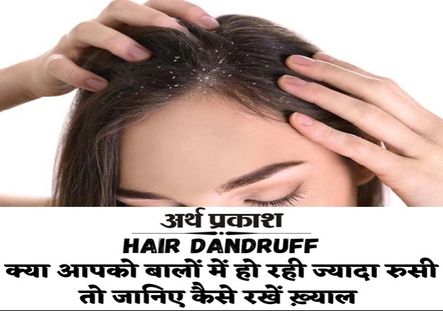 Know the tips to control over hair dandruff.