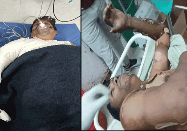 Gau Rakshak Bajrang Force national president Bittu's brother was poured petrol and set on fire