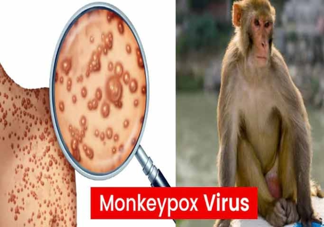 Those coming from abroad should be careful, health ministry issued new guidelines on monkeypox