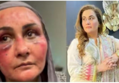 Pakistani Actress Tortured by Husband