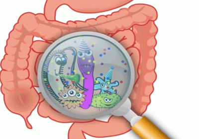 Intestinal bacteria responsible for food addiction and obesity